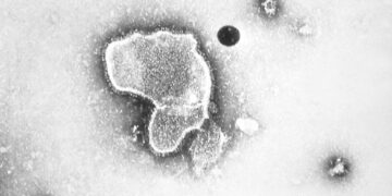 En esta imagen de 1981 se ve una foto de un microscopio de electrones del virus respiratorio sincitial. Foto: CDC vía AP