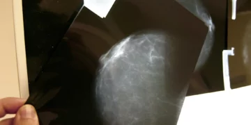 Foto: Chema Moya | EFE (archivo)