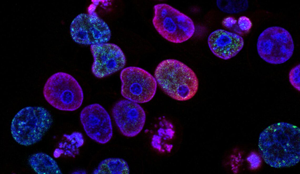 Células de cáncer colorrectal. (Foto: Unsplash / National Cancer Institute)