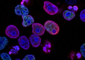 Células de cáncer colorrectal. (Foto: Unsplash / National Cancer Institute)