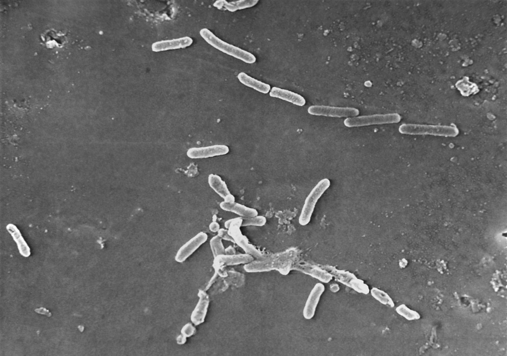 Imagen de microscopio de la bacteria Pseudomonas aeruginosa. (Foto: Janice Haney Carr / CDC vía AP)