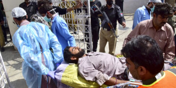 Herido por la explosión de una bomba en Quetta, Pakistán. (Foto: Arshad Butt / AP)
