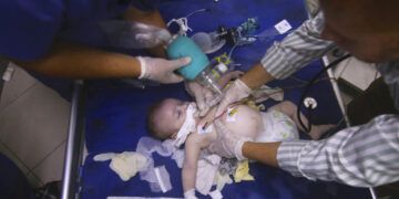 Un bebé palestino herido por bombardeos de Israel es atendido en el hospital de Al-Najar, en Rafah, Franja de Gaza. (Foto: Hatem Ali / AP)